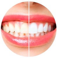 Untitled_design__6_-removebg-preview (1)